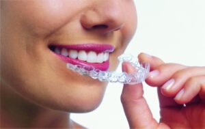 Invisalign First Bedford NH